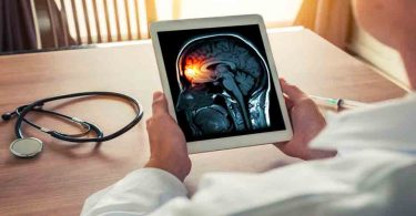 Unlocking the Secrets How Migraine Medicines are Revolutionizing Pain Management