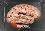 What causes migraine